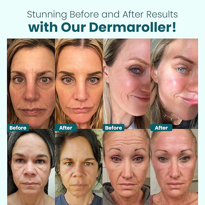 Gin Amber Beauty Derma Roller with Replaceable Head Design – 192 Real individual needles, Micro Needling Roller for Face, Beard, and Scalp Care, 0.25mm Face Roller-Velvo Beauty