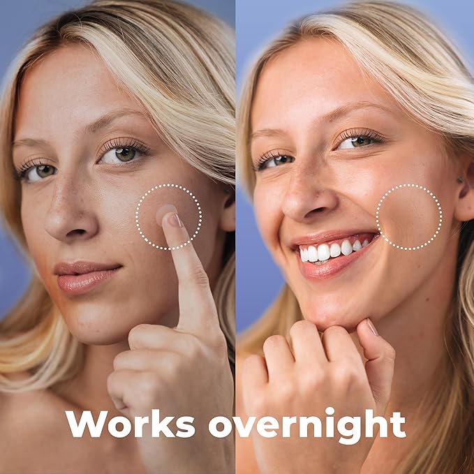 Salicylic Pimple Patches (120 Pack), Salicylic Acid Acne Patches with Tea Tree Oil - Zit Patch and Pimple Stickers for Face for Skin Care - Salicylic Acid Acne Dots (Packaging May Vary)-Velvo Beauty