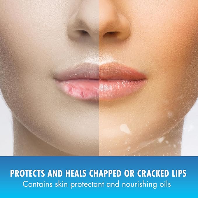 Mentholatum (R) Natural Ice (R) Sport Broad Spectrum SPF 30 Medicated Lip Balm - 12 Pack of 4.5 g Tubes-Velvo Beauty