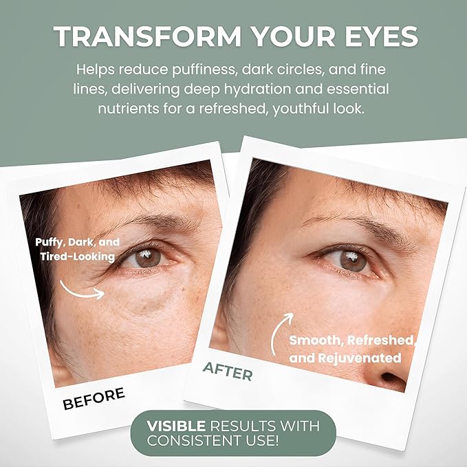 Under Eye Gel - Premium Anti Aging Eye Cream for Dark Circles & Puffiness, Treatment On, Eye Bags Gone, Brightness Glows, 1.7 oz.-Velvo Beauty