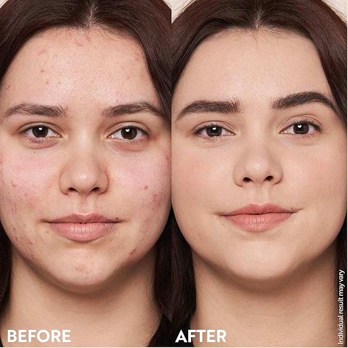 M. Asam Magic Finish Make-Up Mousse (1.01 Fl Oz) – 4in1 Primer, Foundation, Concealer & Powder With Buildable Coverage, Hides Redness And Dark Spots, Vegan, For Light To Medium Skin Tones-Velvo Beauty