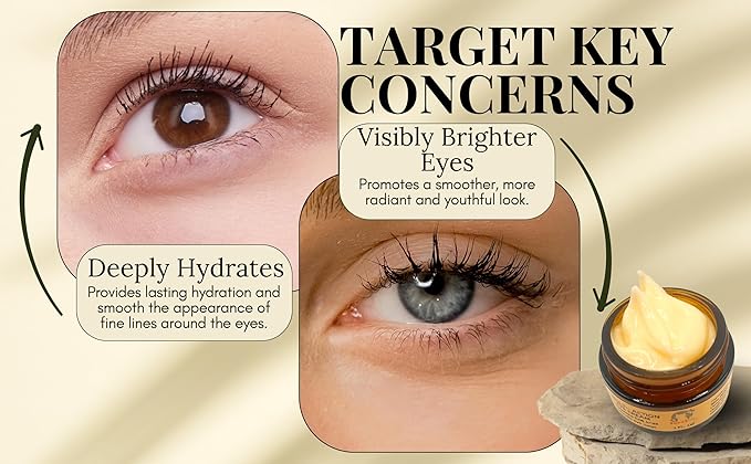 Anti-Aging Eye Cream with Squalane, Nicotinamide, and Panthenol (B5) for Dark Circles, Puffiness, and Fine Lines - 1oz-Velvo Beauty