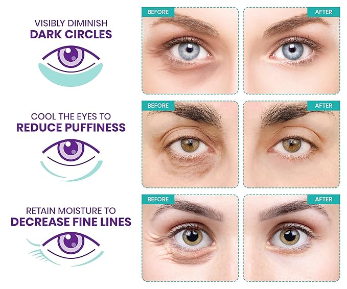 Stylia Under Eye Patches for Puffy Eyes and Dark Circles (30 Pairs) - Marine Collagen Under Eye Mask with Retinol, Vitamin C, Hyaluronic Acid, Pearl Extract - Eye Masks for Dark Circles and Puffiness-Velvo Beauty