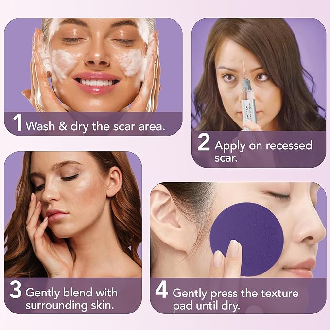 Dermaflage Scar Filler Kit - Light Tan - Deep Scar Cover and Waterproof Concealer for Acne Scars Wrinkles, and Ice Pick Scars Makeup, 1 mo supply-Velvo Beauty