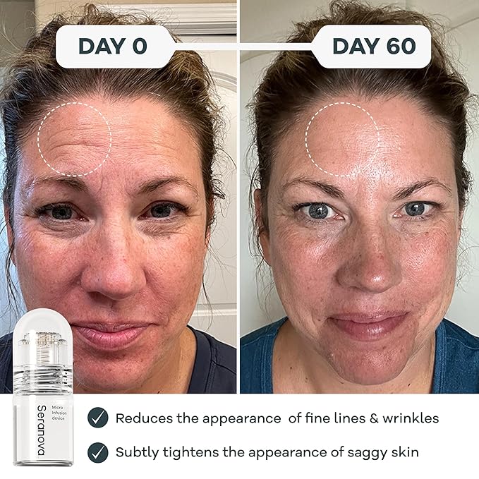 Seranova - Micro Infusion for Skin Care – with Collagen Peptides & Hyaluronic Acid, Face Serum and Stamp 0.05mm - 3 Month Supply-Velvo Beauty