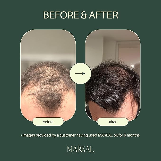 Pure Rosemary Oil for Hair Growth & Scalp Health | Infused with Castor & Coconut Oil | Hair Thickening & Regrowth Treatment for Women & Men | 100% Natural | Up to 2-Month Supply | 1.7 fl oz | MAREAL-Velvo Beauty