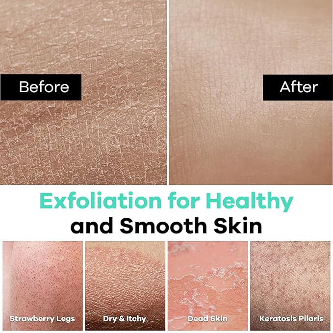 Dermasuri Deep Exfoliating Glove - Polishing Mitt Body Scrubber - Korean Skin Cleaner Exfoliator & Dead Skin Buffing Treatment - Keratosis Pilaris Scrub Remover- Shower Skincare (1 Pack)-Velvo Beauty