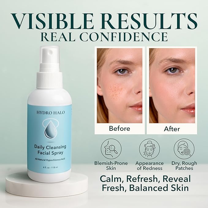 Hypochlorous Acid Spray for Face 4oz – Pure Hypochlorous Acid Spray Cleaner, Daily Cleansing Facial, pH Balanced, Plant Based, No Alcohol, USA Made-Velvo Beauty