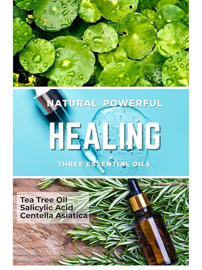 Acne Patch Ultra Thin Invisible Spot Cover- Fast Acting Hydrocolloid Pimple Patch with Salicylic Acid, Centella Asiatica & Tea Tree Oil- 72 Ct. Effective Treatment Absorbs Zits and Blemishes-Velvo Beauty