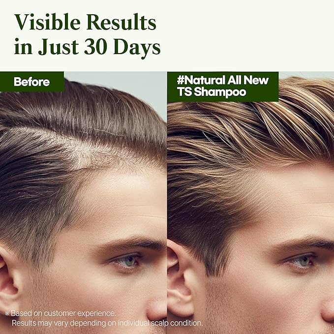 TS Natural All New TS Shampoo | Korean Shampoo for Sensitive Scalp | Hair & Scalp Care with Salicylic Acid and Natural Ingredients | Sulfate-Free Dandruff & Itchy Scalp Relief (16.9 Fl Oz / 500mL)-Velvo Beauty