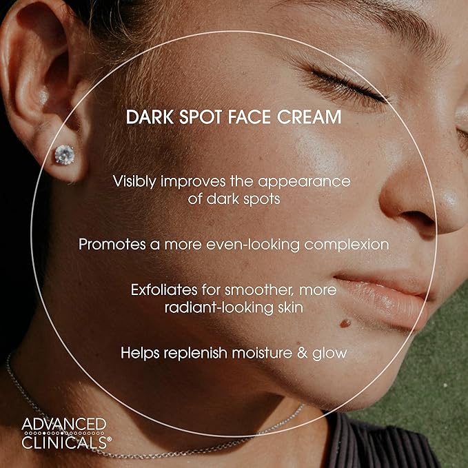 Advanced Clinicals Dark Spot Face Moisturizer | Lactic Acid Lotion For Face With Caffeine, Cocoa Butter, & Vitamin A | Brightening Cream Visibly Reduces Look Of Dark Spots & Uneven Skin Tone, 2 Fl Oz-Velvo Beauty
