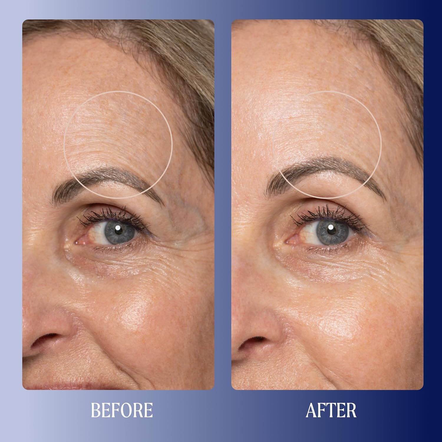 Kinship Super Rich Collagen + Ceramide Firming Cream | Anti Aging, Hydrating Face Moisturizer for Sensitive Skin | Wrinkle Cream - Smooth Fine Lines | Synthetic Fragrance-Free | Derm Approved, (1.7oz)-Velvo Beauty