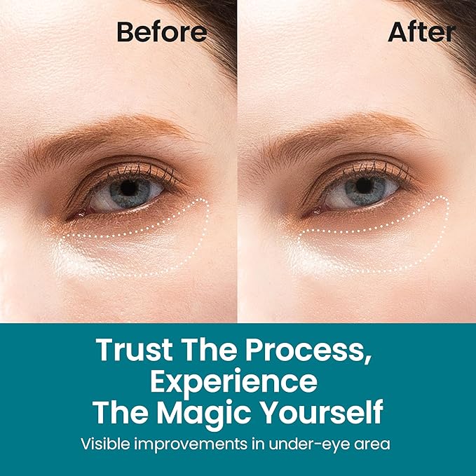 Under Eye Patches for Dark Circles | Korean Under Eye Patches & Puffy Eye Patches | Moisturizing Dark Circles Under Eye Treatment Skincare Snail Mucin Eye Patches & Dark Eyes Circle Treatment-Velvo Beauty