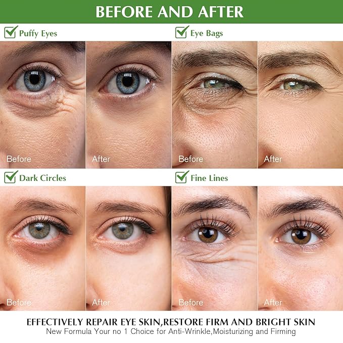 Under Eye Patches for Dark Circles: 30 Pairs Green Tea Eye Gels Pads - Reduce Eye Bags, Wrinkles & Puffy - Skin Treatment Mask Retinol Collagen - Anti Aging & Face Moisturizer For Women (Green Tea)-Velvo Beauty