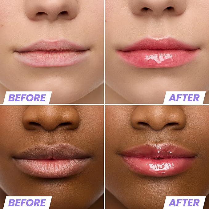 Wonderskin Lip Oil Rehab Serum - Tinted Lip Oil for Women, Hydrating, Moisturizing, and Non-Sticky Red Tint Serum for Dry Lips (Amour)-Velvo Beauty