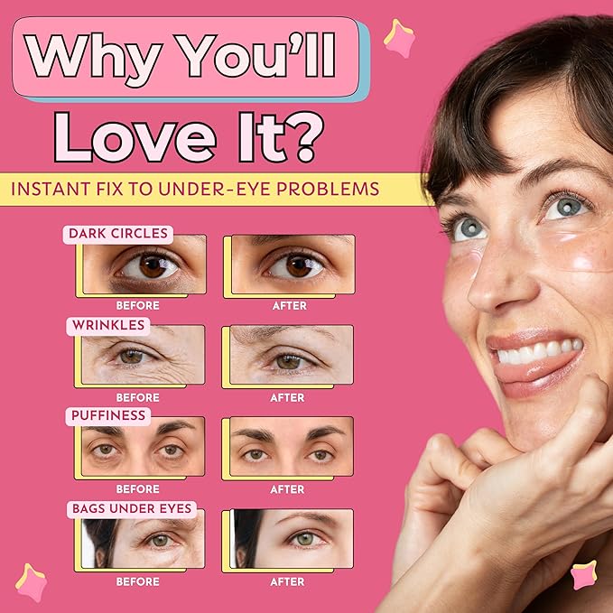 RevitalEyez Brightening Hydrogel Under Eye Patch with Niacinamide, Collagen & Rose Petals for Puffy Eyes, Wrinkles, Dark Circles (10 pairs)-Velvo Beauty