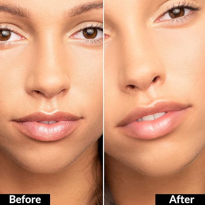 True + Luscious Flowerdose Lip & Eye Serum – 2-in-1 Lip Plumping & Eye Serum for Dry Lips and Dark Circles – Intensely Hydrating, Anti-Aging Formula – 0.5 oz-Velvo Beauty