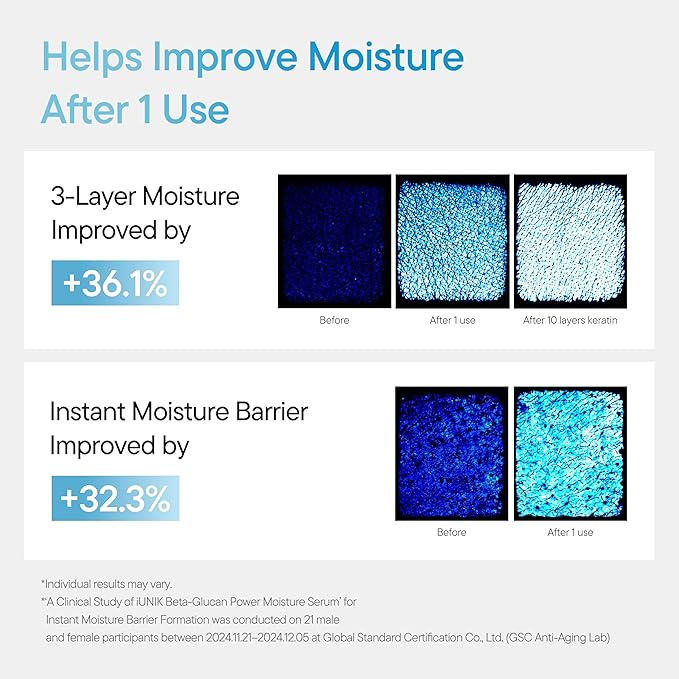 IUNIK Beta-Glucan Power Deep Moisture Vegan Serum Intense Hydration Mushroom Yeast Extracts Naturally-derived - Dry Mature Sagging Sensitive Skin Cell Regenerating Lifting Korean Skincare-Velvo Beauty