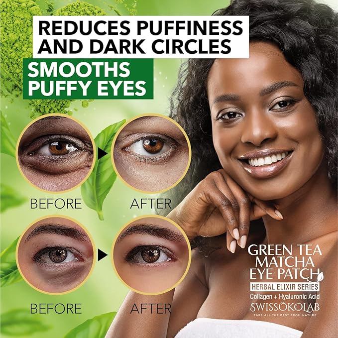 SWISSÖKOLAB Under Eye Patches For Puffy Eyes 24k Gold Eye Mask Dark Circles And Puffiness Collagen Eye Gel Pads Moisturizing & Reducing Wrinkles Anti-Aging Hyaluronic Acid (Green Tea)-Velvo Beauty