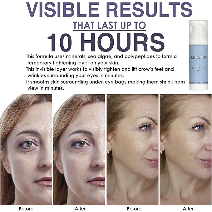 Instant Eye Lift Serum - Provides Immediate Visible Results, Lifts Away Appearance of Lines & Wrinkles. Dark Circles Under Eye Treatment, Eye Cream for Dark Circles and Puffiness-Velvo Beauty