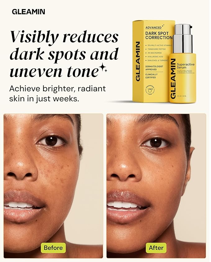 Gleamin Superactive Vitamin C Serum for Face with 15% Vitamin C, Niacinamide, Bakuchiol & Hyaluronic Acid – Skin Brightening Facial Serum for Women & Men – Dark Spot Remover & Radiant Glow – 1 fl oz-Velvo Beauty
