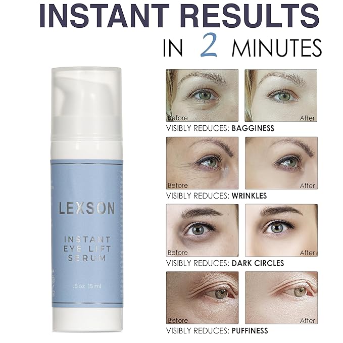 Instant Eye Lift Serum - Provides Immediate Visible Results, Lifts Away Appearance of Lines & Wrinkles. Dark Circles Under Eye Treatment, Eye Cream for Dark Circles and Puffiness-Velvo Beauty