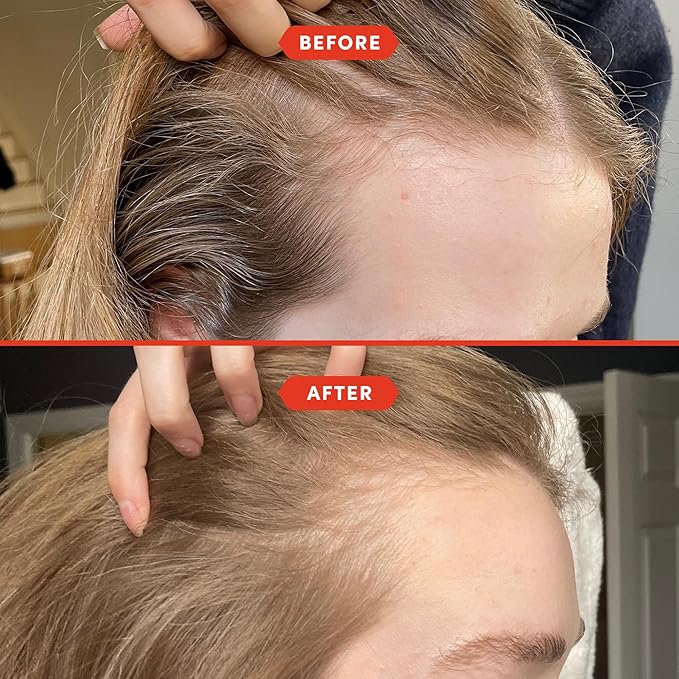 Fable and Mane Hair Oil - HoliRoots Strengthening Serum for Damaged, Frizzy Hair with Amla, Castor Oil for Hair Health - 3.4FL oz-Velvo Beauty