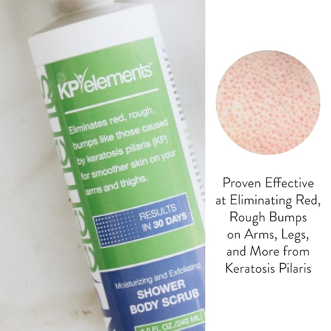 KP Elements Body Scrub (8 fl oz) | Keratosis Pilaris Treatment | Exfoliating Body Scrub and Body Moisturizer for Dry Skin | Helps Reduce Red Bumps | Body Skin Care Product for Men and Women-Velvo Beauty