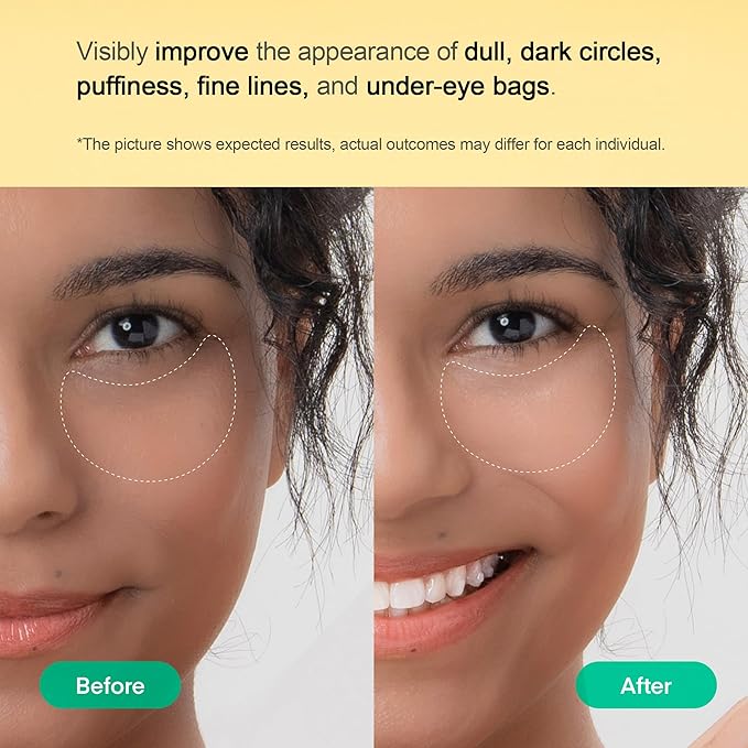 TEREZ & HONOR Vitamin C Eye Patches - 60 Pcs Korean Brightening & Hydrating Under Eye Masks with Tranexamic Acid, Caffeine, Hyaluronic Acid - Dark Circles, Puffiness & Wrinkles Hydrogel Treatment-Velvo Beauty