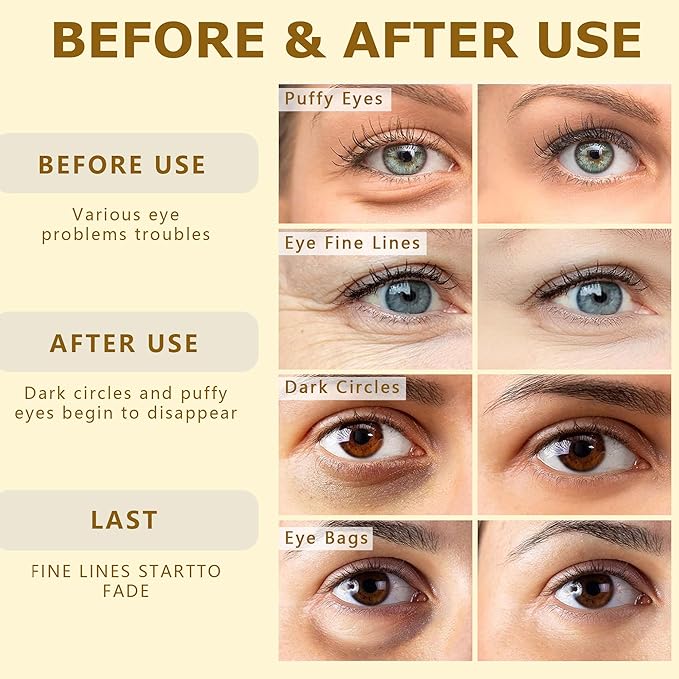 COSMETIC |24k Gold Vitality-Fill Hydra-Gel Eye Patches | Anti-Aging Under-Eye Patches, Help Boosting Lift & Firm the Look of the Eye Area-Velvo Beauty