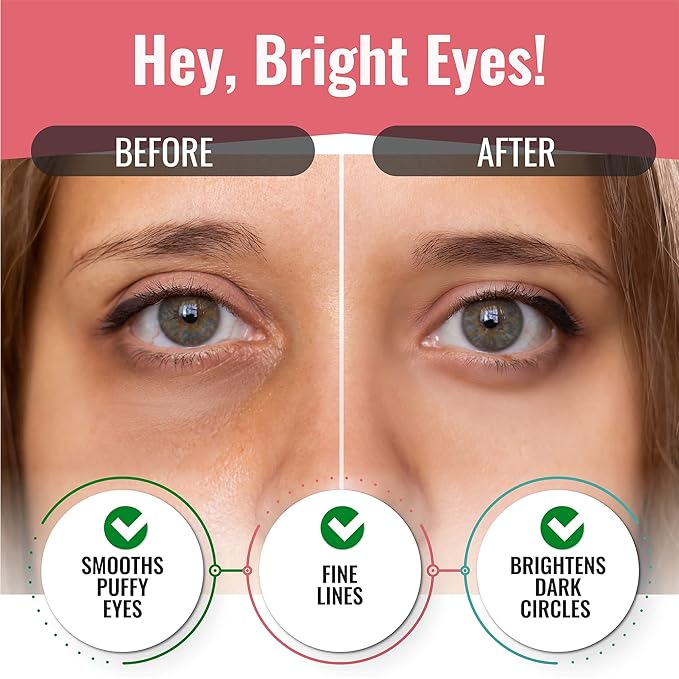 Under Eye Patches for Dark Circles and Puffiness (20 Pairs) - Korean Skin Care Caffeine Collagen Eye Patches for Puffy Eyes -Hydrogel Eye Patch - Under Eye Mask - Aloe Vera Rose Green Tea Gel Eye Pads-Velvo Beauty