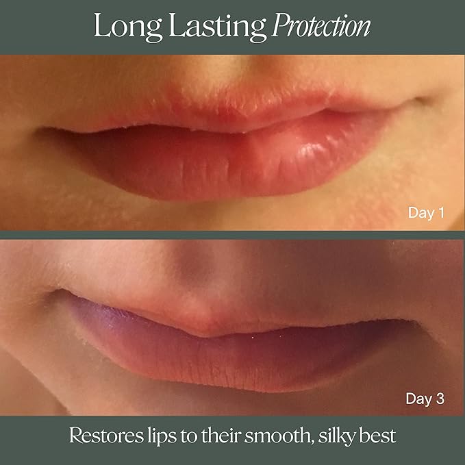 Doctor Rogers Lip Balm, Hydrating and Softening Lip Moisturizer For Very Dry Lips, Dermatologist-Created, Natural, & Hypoallergenic Moisturizing Lip Balms, 4.25g Tube-Velvo Beauty