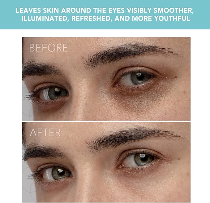 FOREO IRIS Eye Massager Dark Circle Remover & Eyebag Remover Eye Depuffer Anti Aging Increases Absorption of Eye Mask Essences| Waterproof 2-year Warranty Mint-Velvo Beauty