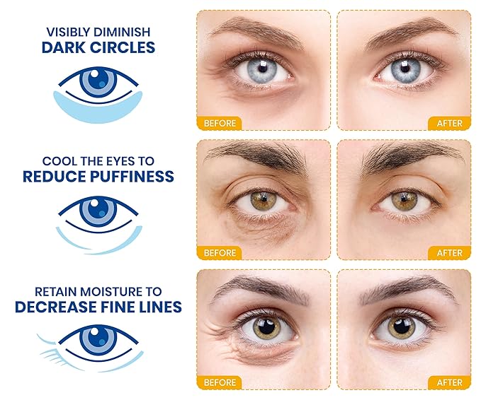 Stylia Under Eye Patches for Puffy Eyes and Dark Circles (20 Pairs) - 24k Gold Under Eye Mask with Vitamin C, Hyaluronic Acid, Pearl Extract - Eye Masks for Dark Circles and Puffiness-Velvo Beauty