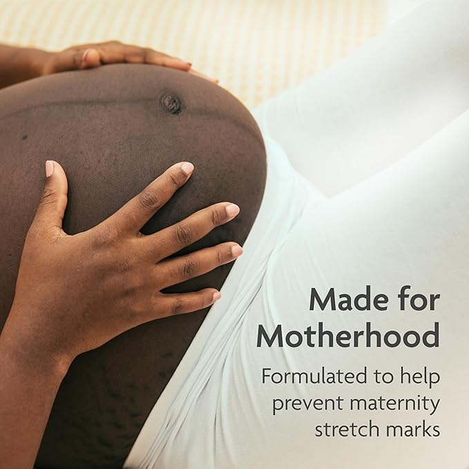 TriLASTIN-SR Intensive Stretch Mark Cream (5.5 oz.) for Pregnancy, Scar Cream and Moisturizing Lotion, Cocoa Butter, Scar Treatment, Hypoallergenic and Paraben-Free-Velvo Beauty