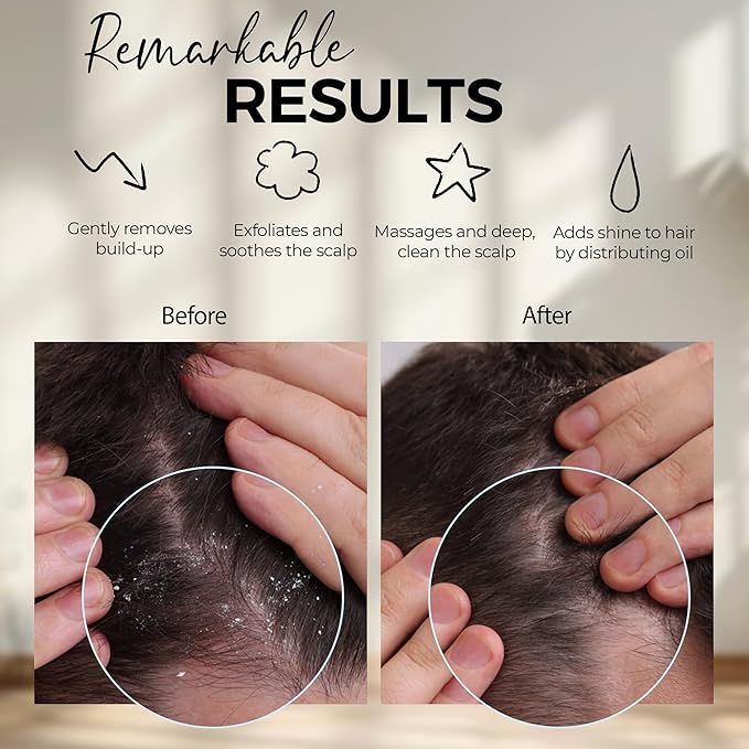 Fiora Naturals Scalp Massager Shampoo Brush - Silicon Scalp Scrubber & Exfoliator for Dandruff Removal and Hair Growth, Scalp Brush for Wet & Dry Hair, Shampoo Brush for Men, Women, Kids - BPA Free-Velvo Beauty