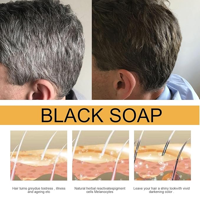 3PCS Hira Darkening Polygonum Shampoo Bar for Gray, Thinning Hair and Hair Growth (he shouwu) - Soap Bar-Velvo Beauty
