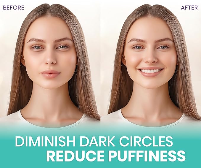 Stylia Under Eye Patches for Puffy Eyes and Dark Circles (30 Pairs) - Marine Collagen Under Eye Mask with Retinol, Vitamin C, Hyaluronic Acid, Pearl Extract - Eye Masks for Dark Circles and Puffiness-Velvo Beauty