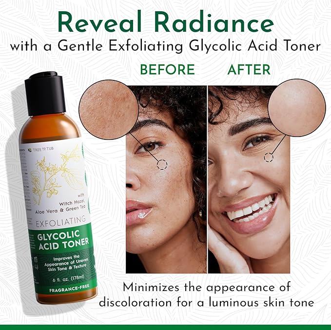 Tree To Tub Glycolic Acid Toner for Face w/Witch Hazel & Hydrating Aloe Vera for Smooth Skin - Minimizes Appearance of Fine Lines & Brightens - Vegan Exfoliating Toner for Women & Men-Velvo Beauty