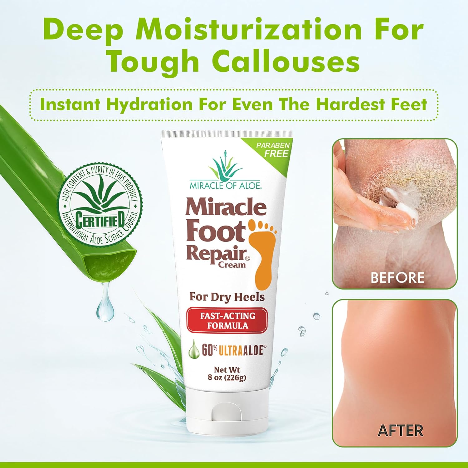 Miracle Foot Repair Cream (8 oz & 1 oz) Repairs Dry Cracked Heels and Feet, 60% Pure UltraAloe Moisturizes, Softens, and Repairs-Velvo Beauty