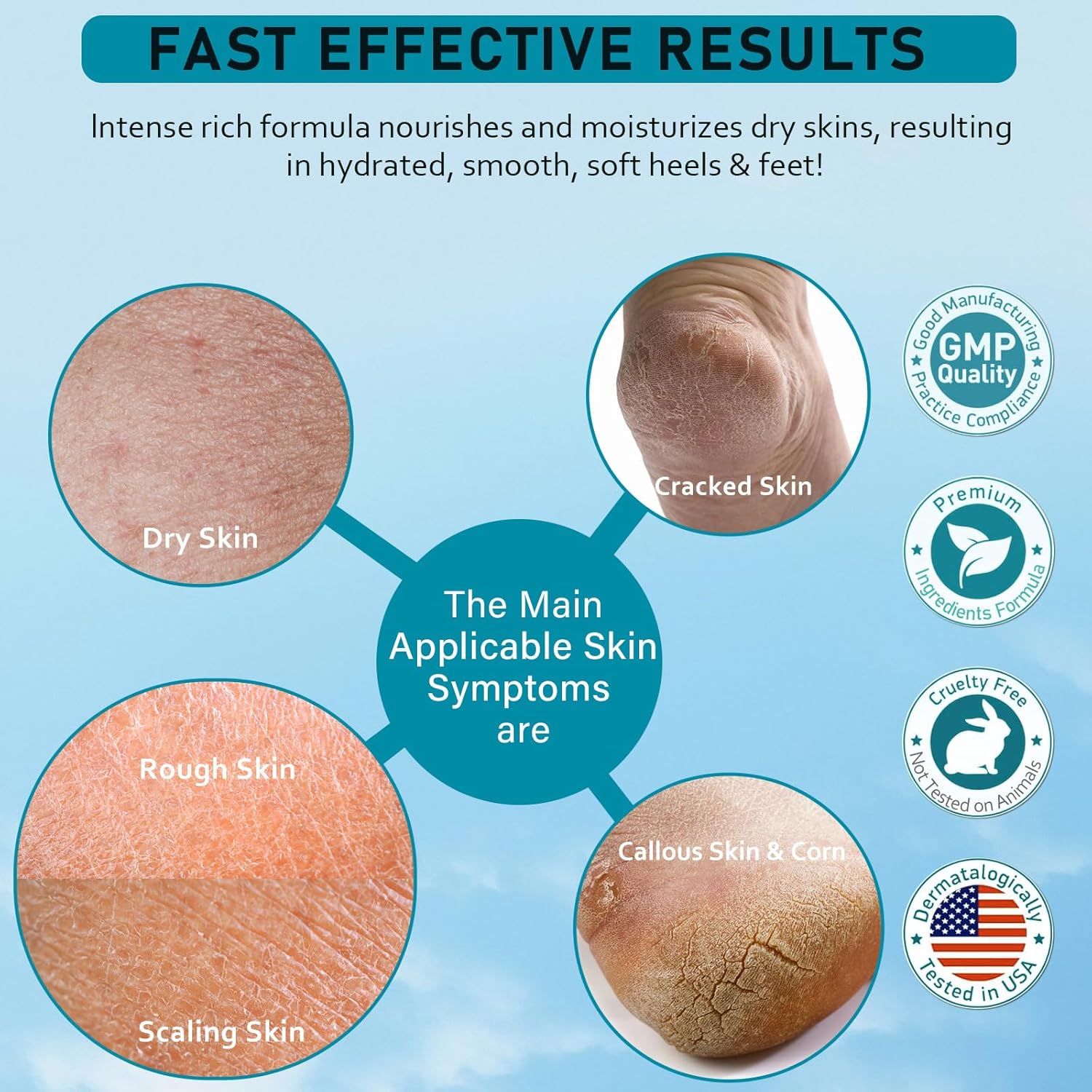 Urea Cream 40 Percent For Feet Maximum Strength - plus Salicylic Acid 2% Foot Cream For Dry Cracked Heels Feet Knees - Dead Skin Cuticle Callus Remover Toenail Softener - Pack of 2-Velvo Beauty