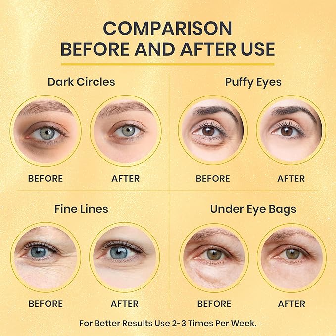 24k Gold Under Eye Patches for Puffy Eyes (7 Pairs) – Gold Foil Under Eye Masks for Dark Circle with Betaine, Hyaluronic Acid – Skincare Eye Bags Patches Treatment for Men & Women-Velvo Beauty