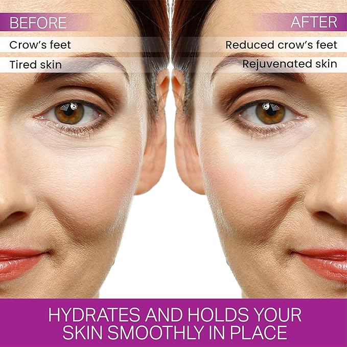 Furlesse Crows Wrinkle Patches, Overnight Eye Patches for Wrinkles and Crow’s Feet Lines, Non-invasive Anti-Wrinkle Patches, Anti-aging Skincare, 60 Patches, 30-Day Use-Velvo Beauty