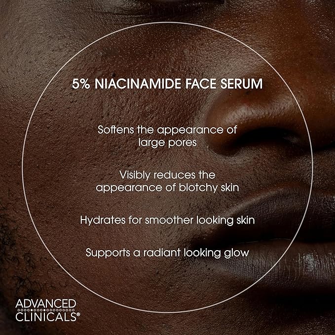 Advanced Clinicals Niacinamide Serum | 5% Niacinamide Serum For Face With Hyaluronic Acid, Ferulic Acid, Aloe Vera, & Fruit Extracts Helps Improve Look Of Dark Spots & Uneven Skin Tone, 1.75 Fl Oz-Velvo Beauty