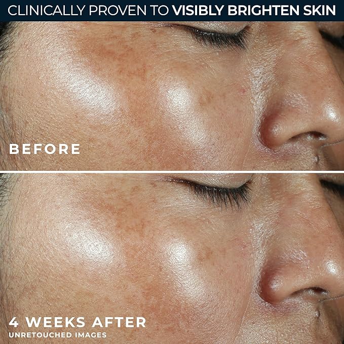 RoC Multi Correxion Revive + Glow Vitamin C Sunscreen Broad Spectrum SPF 30 Face Moisturizer (1.7 oz) with Retinol Eye Cream Packette-Velvo Beauty