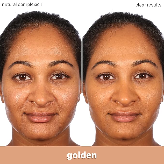 Almay Clear Complexion Acne Foundation Makeup with Salicylic Acid - Lightweight, Medium Coverage, Hypoallergenic, Fragrance-Free, for Sensitive Skin, 710 Natural Tan, 1 fl oz.-Velvo Beauty