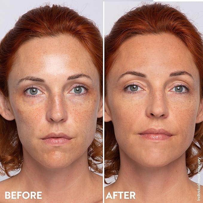 M. Asam Magic Finish Summer Teint Make-Up Mousse (1.01 Fl Oz) – 4in1 Primer, Foundation, Concealer & Powder With Buildable Coverage, Hides Redness And Dark Spots, Vegan, For Medium To Deep Skin Tones-Velvo Beauty