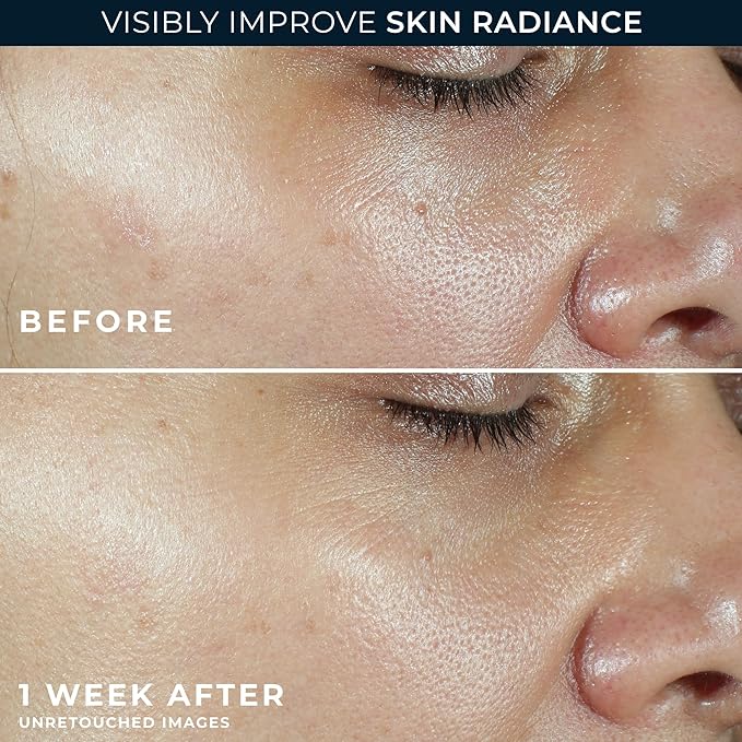 RoC Multi Correxion Revive + Glow Vitamin C Sunscreen Broad Spectrum SPF 30 Face Moisturizer (1.7 oz) with Retinol Eye Cream Packette-Velvo Beauty