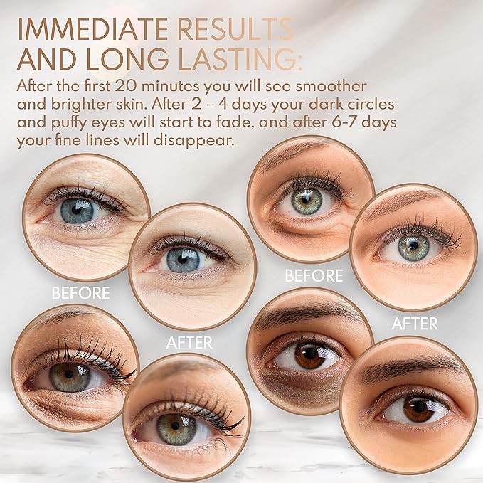 Under Eye Anti-Aging Eye Mask Collagen Patch Treatment for Minimizing Wrinkles, Puffy Eyes, Eye Bags, Dark Circles, Fine Lines Under the Eye, Looking Less Tired, Revitalizing, Moisturizing and Refreshing Your Skin 12 Pairs (Gold)-Velvo Beauty