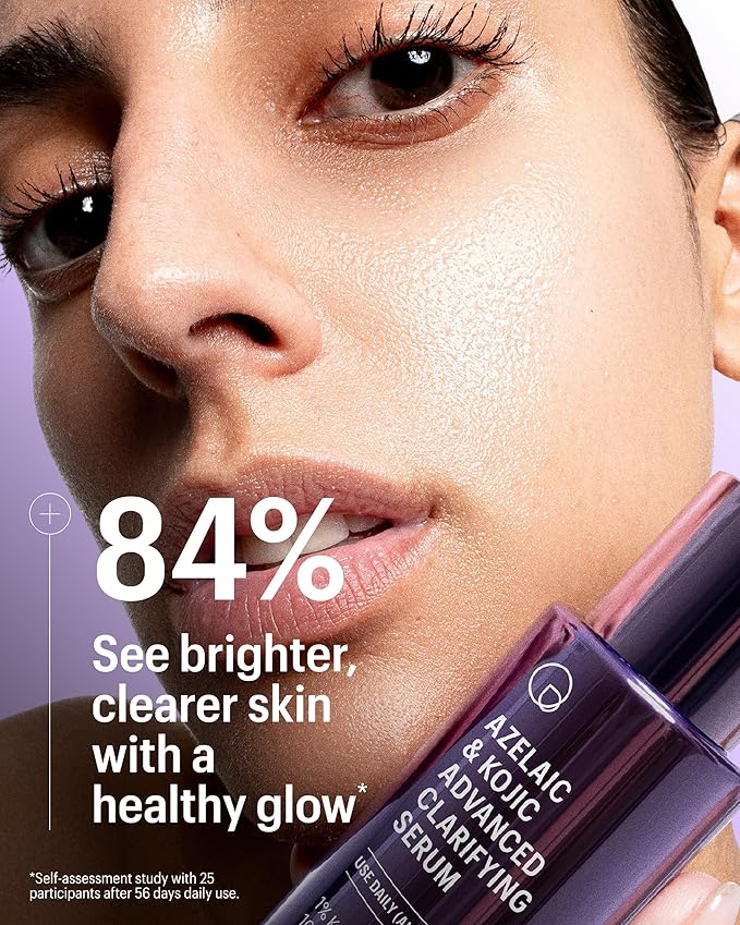 Allies of Skin Azelaic & Kojic Clarifying Face Serum | Clinically Proven for Acne & Blemish Prone Skin |10% Azelaic Acid Treats Pigmentation and Redness | Targets Pores & Uneven Skin Texture (1 Fl oz)-Velvo Beauty